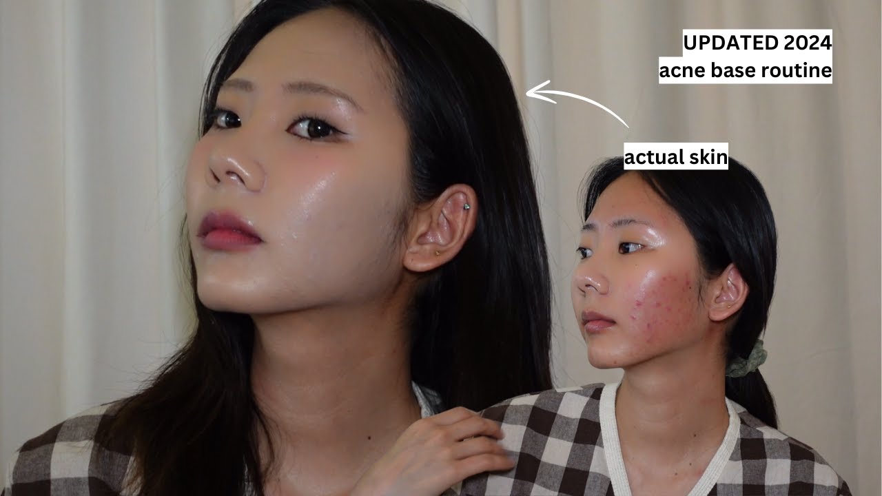 acne skin ࣪ ִֶָ☾. acne base routine | how to cover acne with makeup | fake perfect skin | 2024