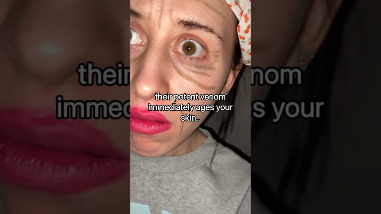 beware of the Ring Fish bite..