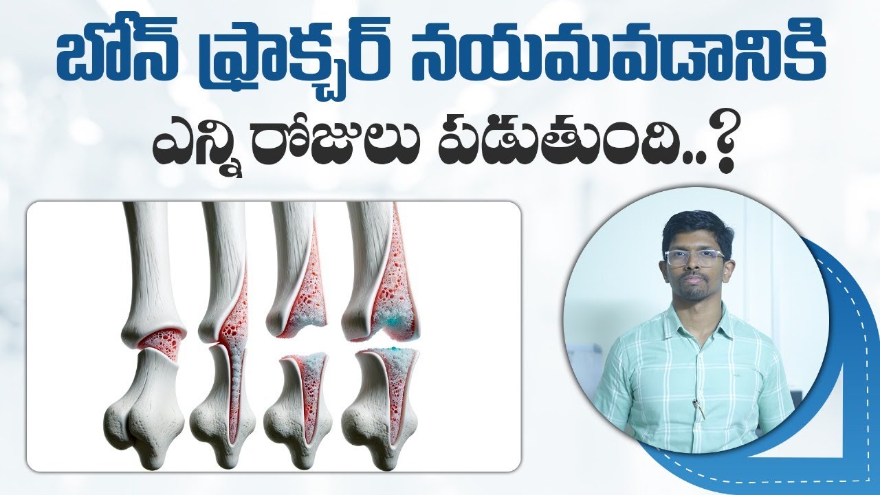 #fractureseries | Fracture Healing Process | Bone Healing | Cure | Dr. Vamshis Orthopaedic Center