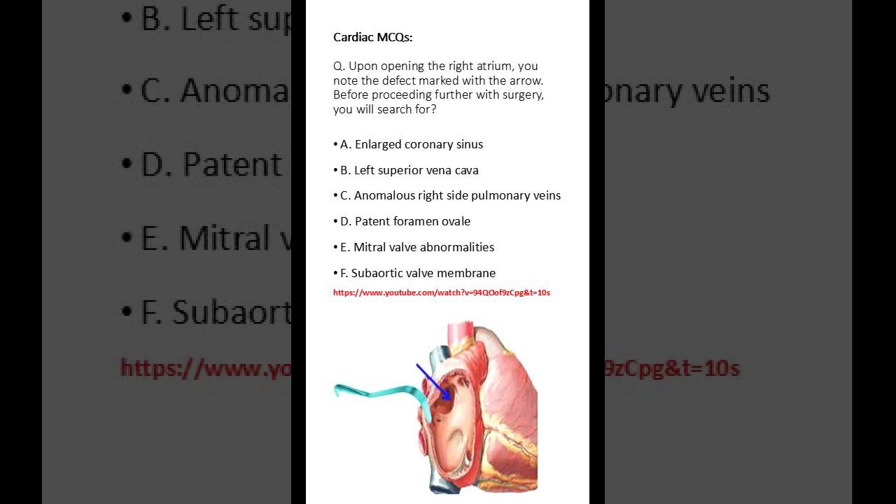 Medicine & Surgery MCQs (For MBBS, USMLE, MCCQE & PLAB)