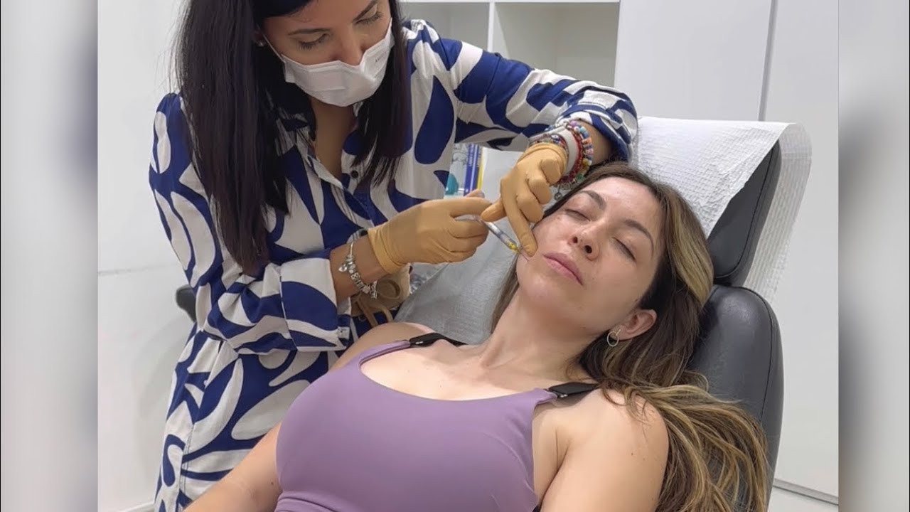 Radiesse Filler en Colima