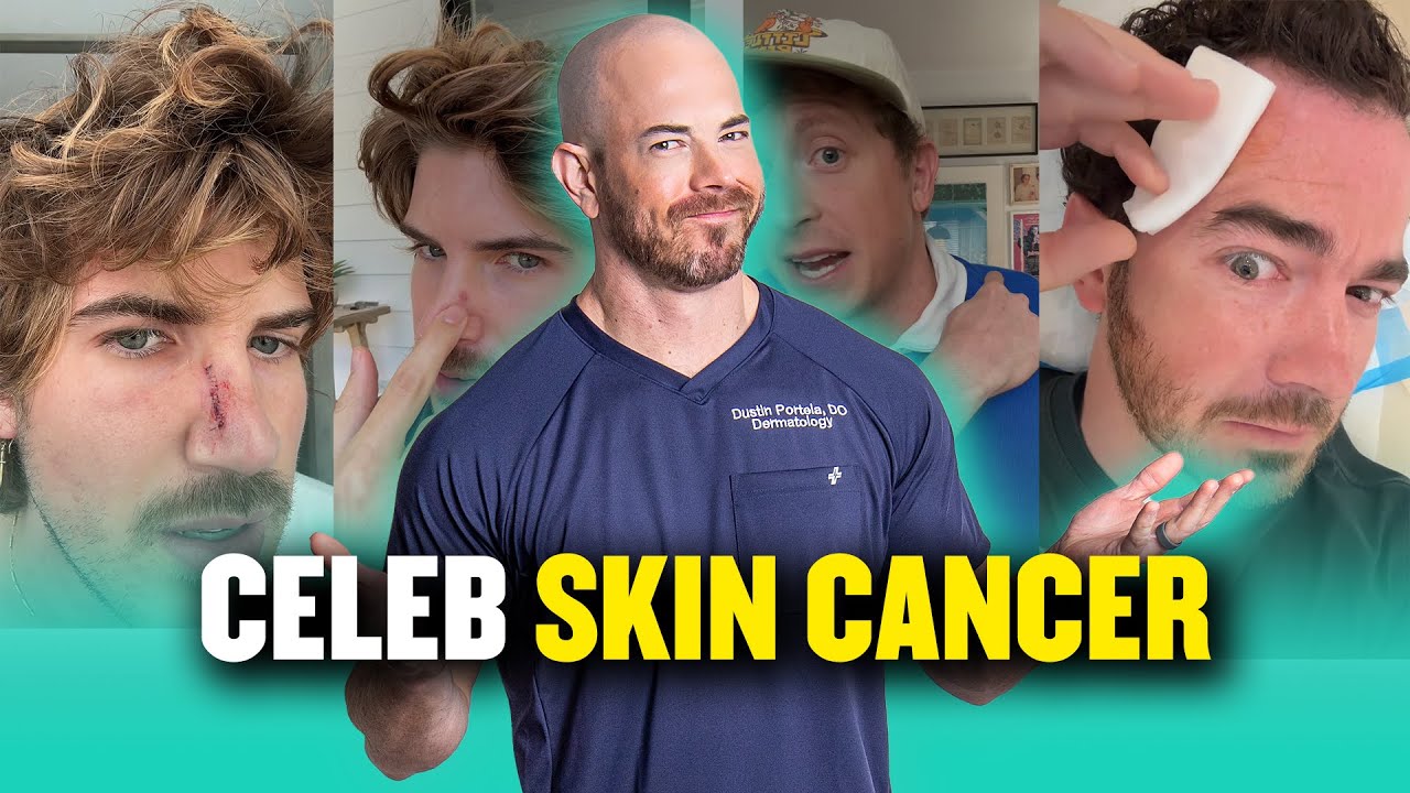 Hollywood Celebrities' Skin Cancer Scare