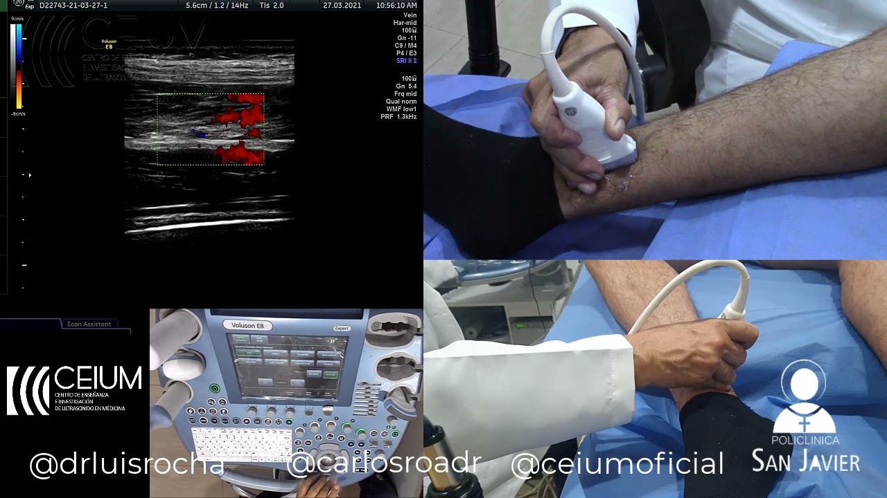 CEIUM TUTORIAL PARTE 4 DOPPLER ARTERIAL MIEMBRO INFERIOR