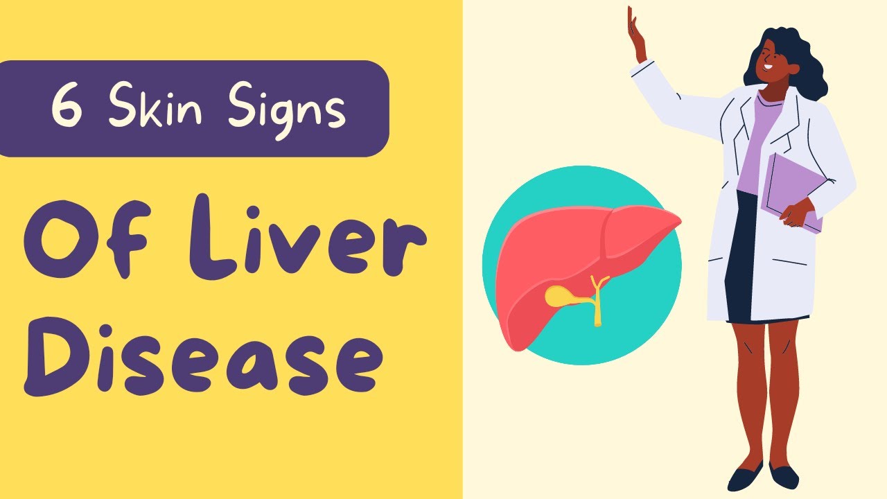 5 unexpected skin changes caused by liver disease || How your skin can reveal liver disease?