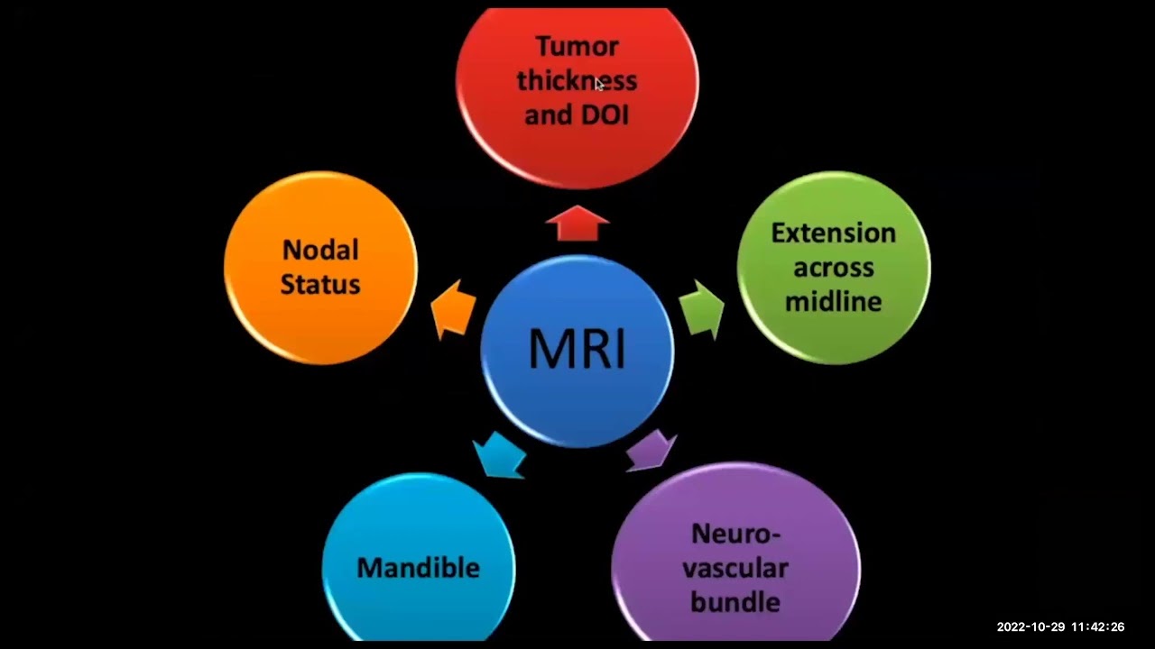Imaging in Carcinoma of the Tongue by Prof Dr Abishek Mahajan