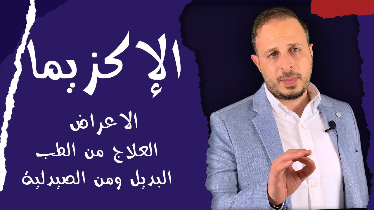 علاج الاكزيما بالادوية وبالطب البديل لنتائج رائعة