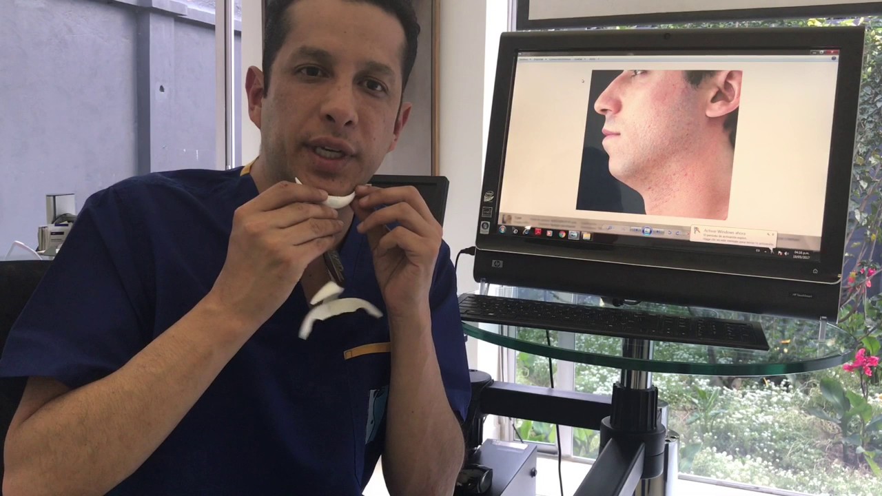 Mentoplastia | Dr. Ivan Santos - Cirugía plástica en Colombia |