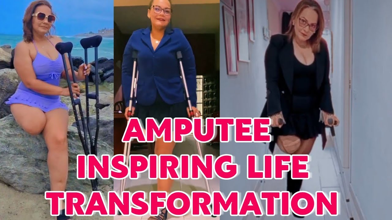 Amputee lady adaptive crutches user | embracing inspiring life transformation
