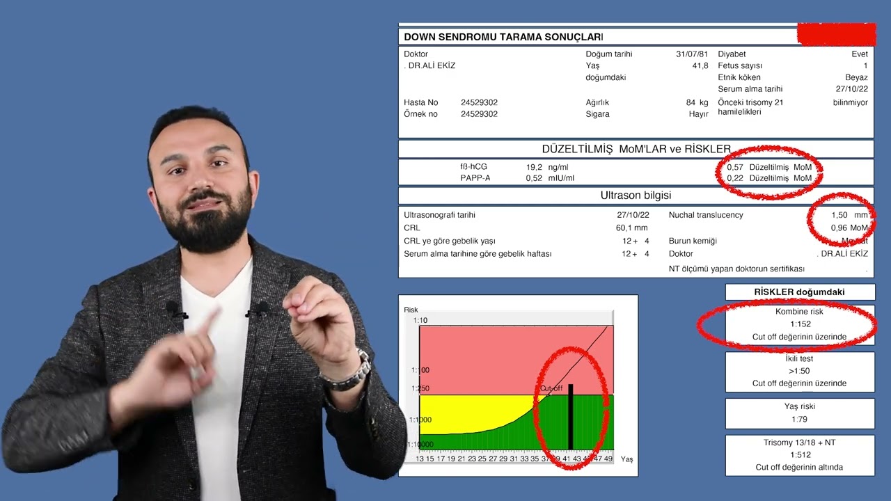 Bebeğime Down dediler normal çıktı! Bu doğru olabilir mi? I Doç. Dr. Ali Ekiz