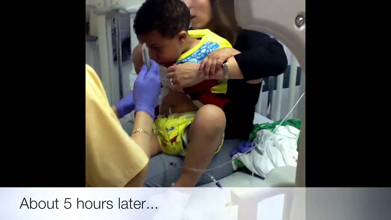 Case's Elaprase Treatment