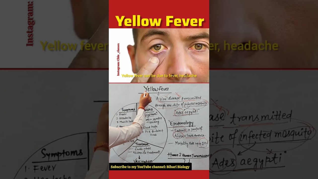 Yellow Fever Overview 🔥 #neet #humanbodysystem #nursing #neet