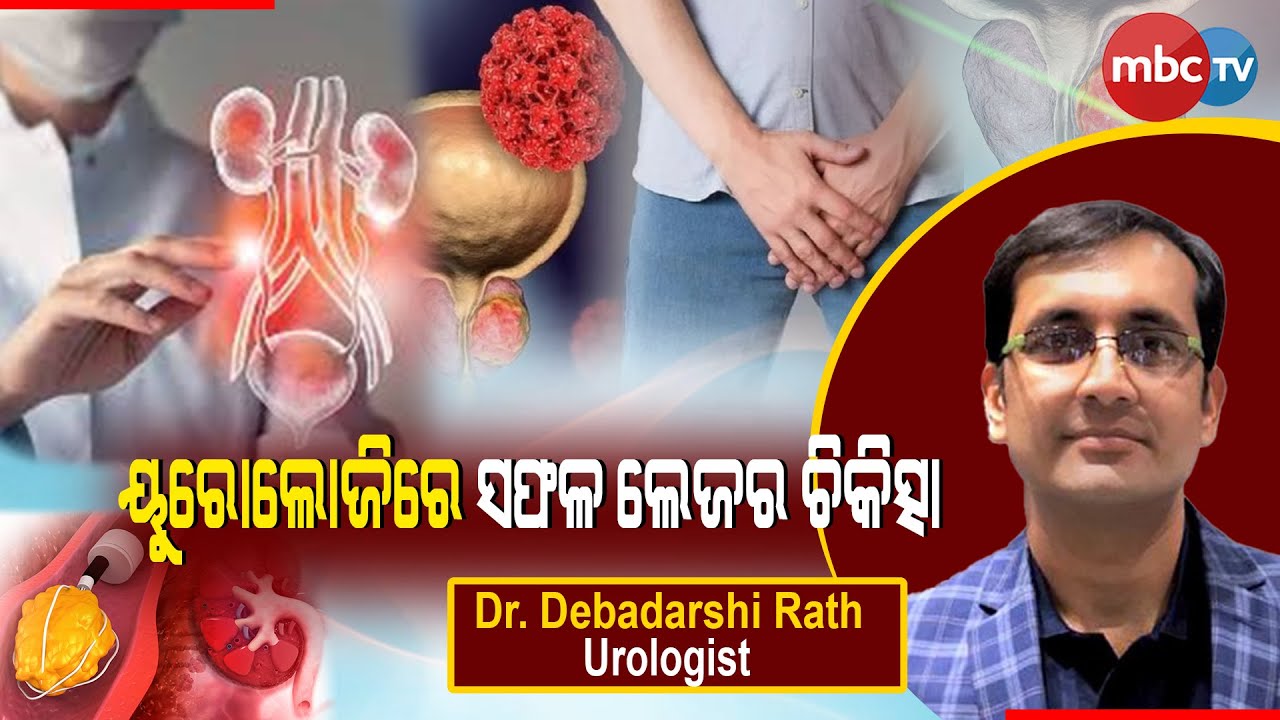 Laser Treatment in Urology by Dr. Debadarshi Rath, Urologist@mbctvodisha8427