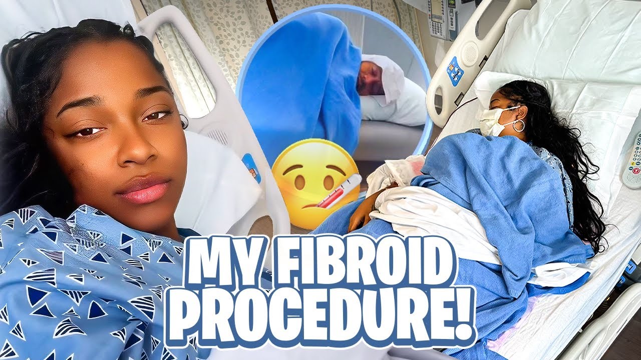 Uterine Fibroids Embolization Recovery/ Procedure. 🤒🤕