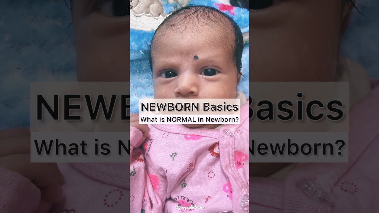 Newborn passing stools after every feeding- Is it normal? #babycare