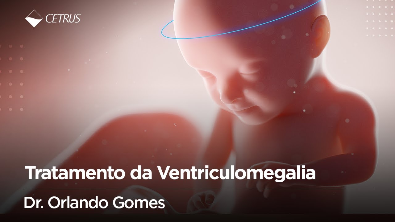Tratamento da Ventriculomegalia | Dr. Orlando Gomes