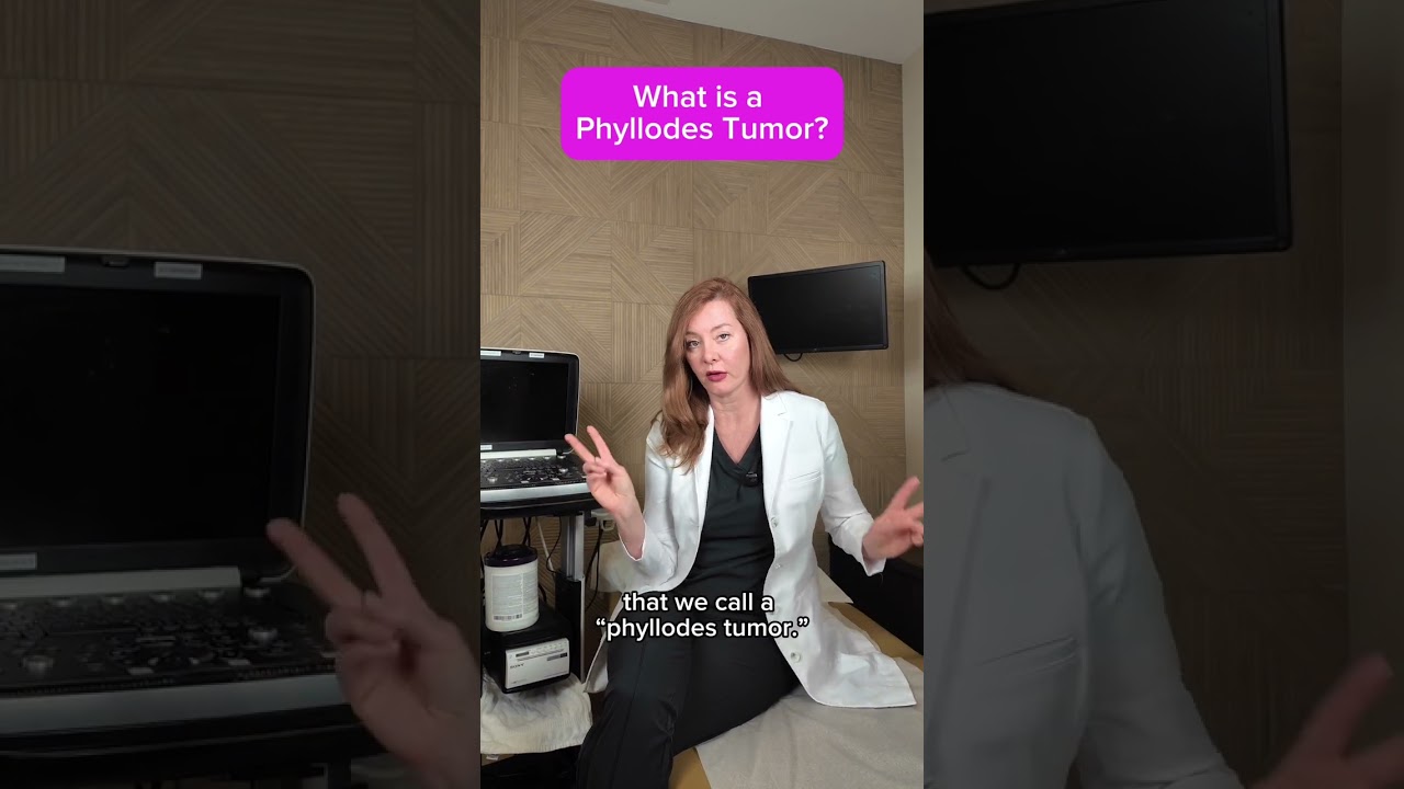 Can Fibroadenomas Turn into Cancer?