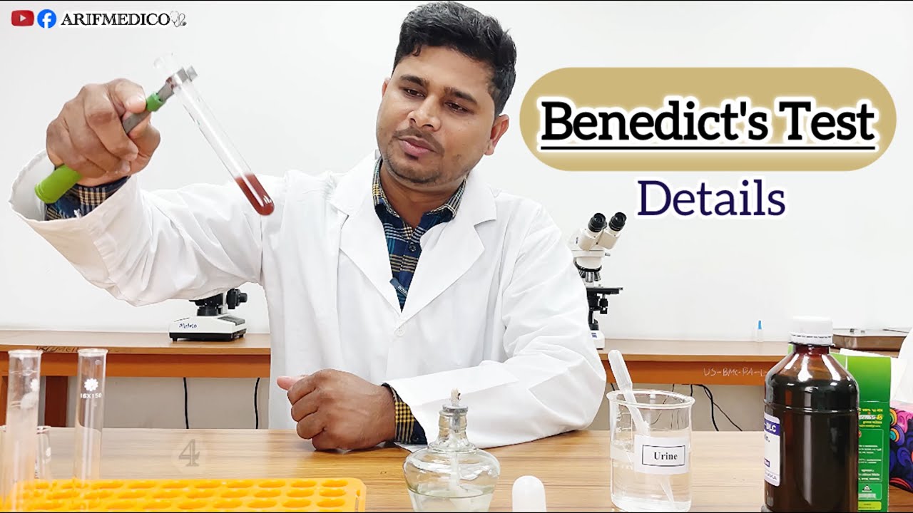 Benedict's Test || Principle,Procedure and result || Benedict's Bangla #benedicttest