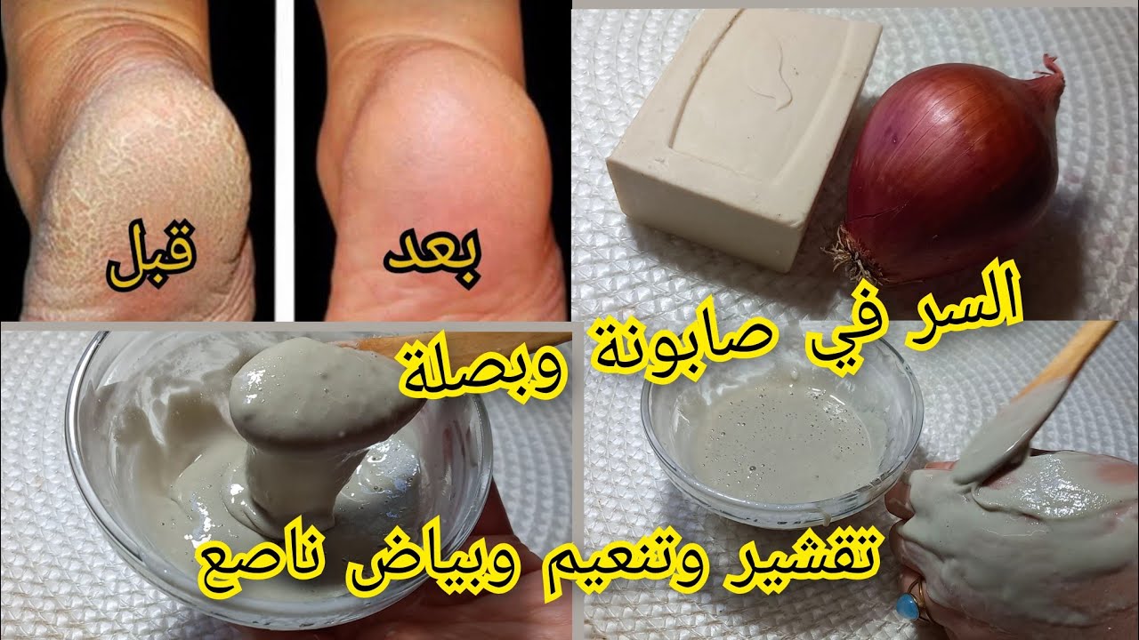 خلطة القدمين السحرية والحصرية  تهنيك من تشققات والجلد الخشن وليتراس السندالة رجليك يشعلو شعيل💥