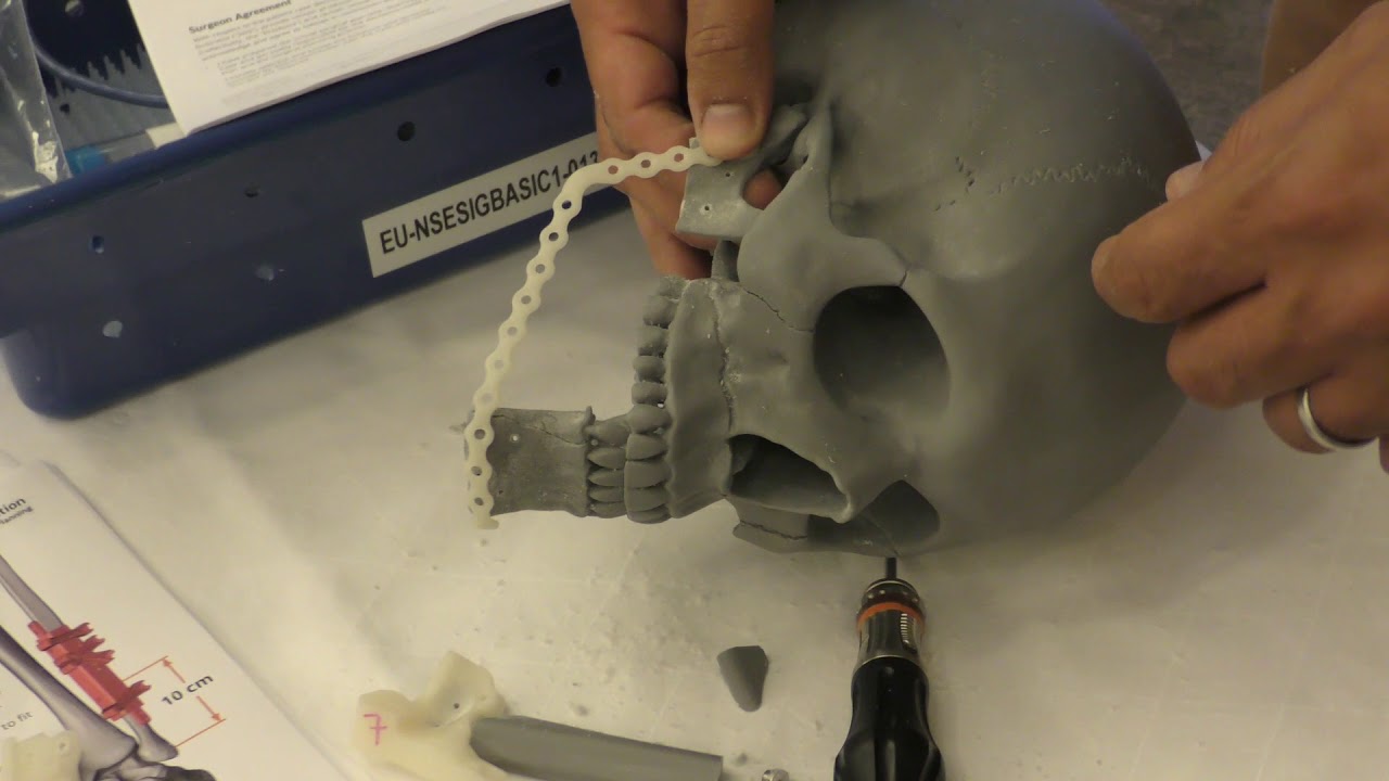Virtual Surgical Planning Styker Course EACMF Munich 2018 Part 1