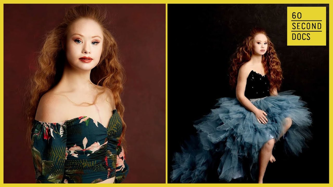 Madeline Stuart, World’s 1st Professional Model w/ Down Syndrome