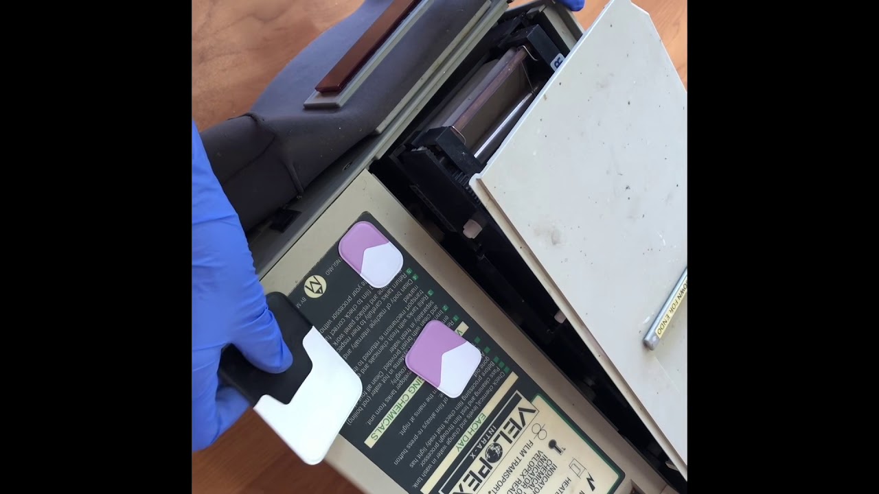 Automatic Processing Of An X-ray Film
