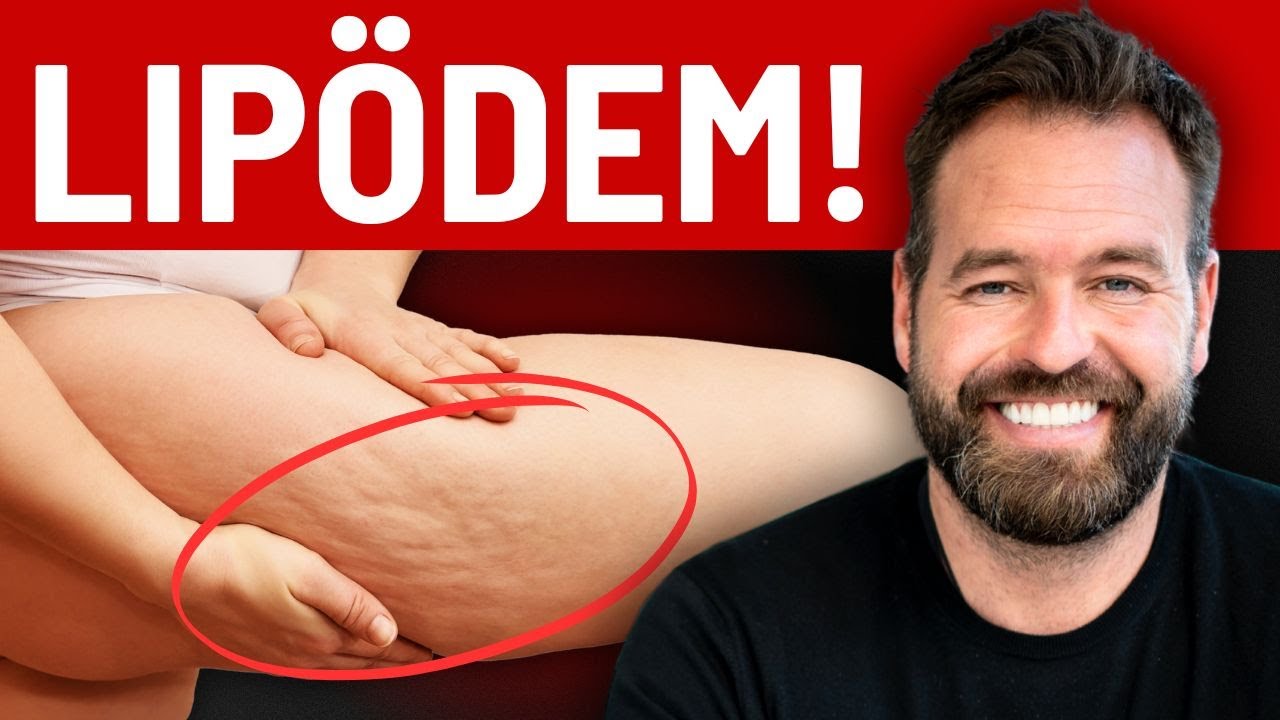 Lipödem-Schock: Warum Ärzte oft die falsche Diagnose stellen!