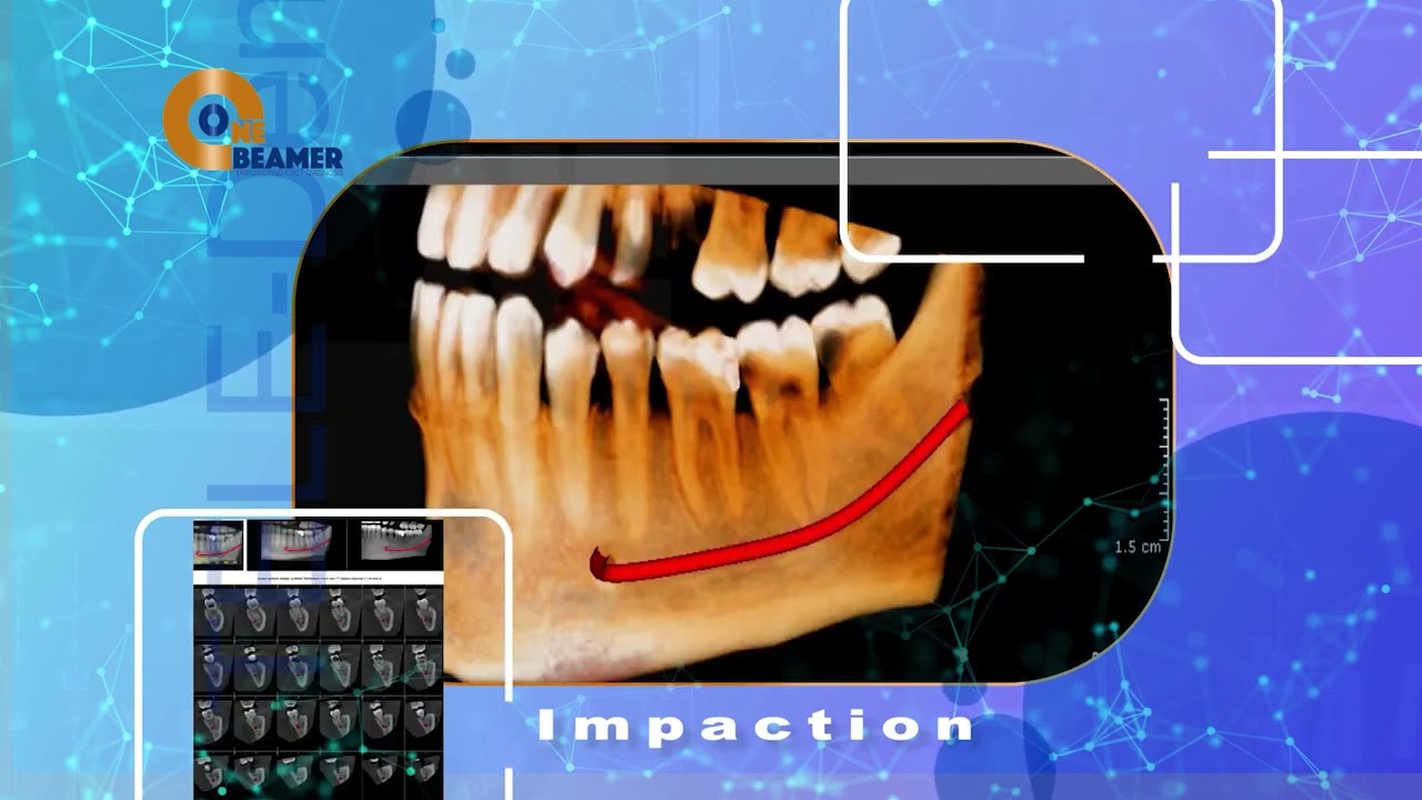 Real cases. Precise CBCT insights. Powered by ConeBeamer