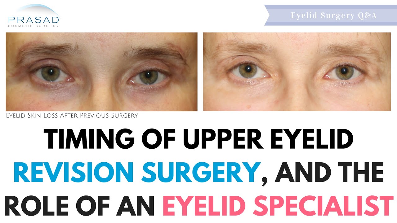 Timing for Upper Eyelid Revision Surgery, and the Role of an Eyelid Specialist