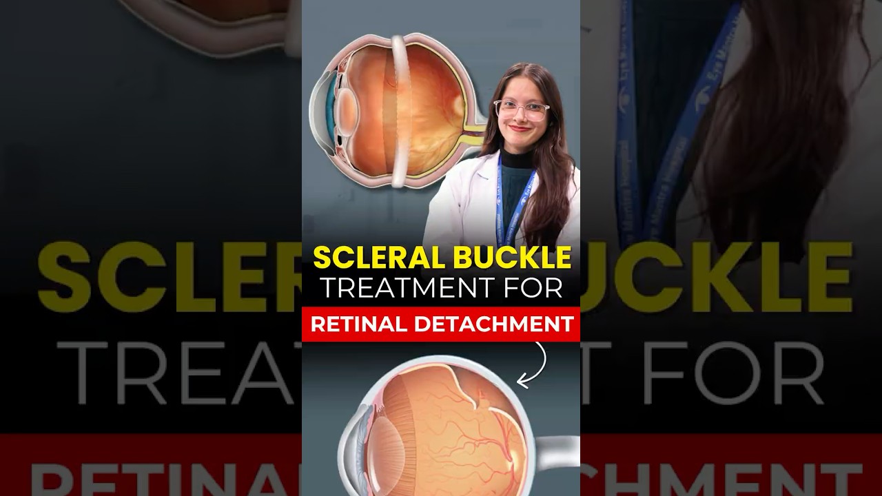 Scleral Buckle Surgery | Retinal Detachment Treatment