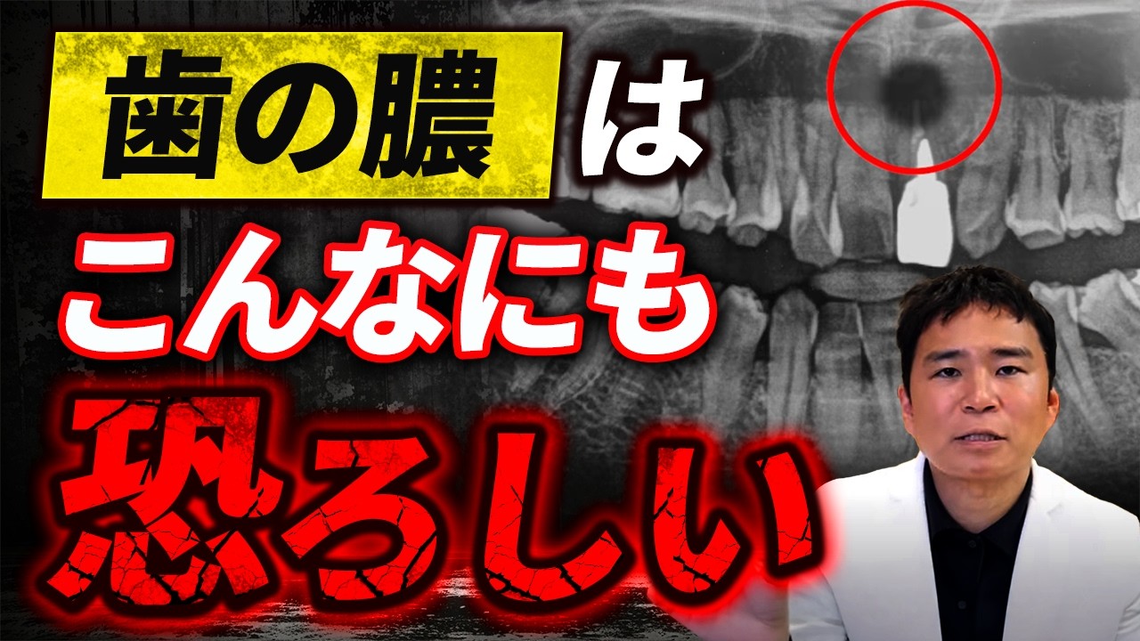 これがある人は要注意！歯の膿は百害あって一理なしです