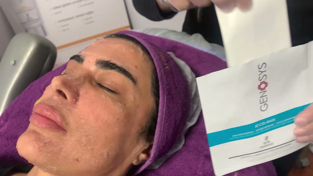 Genosys Ez CO2 Mask Uygulaması - Ata Estetik Beauty & Wellness / Evrim Çetinkaya