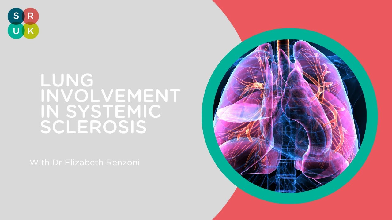 Lung Involvement in Systemic Sclerosis with Dr Renzoni