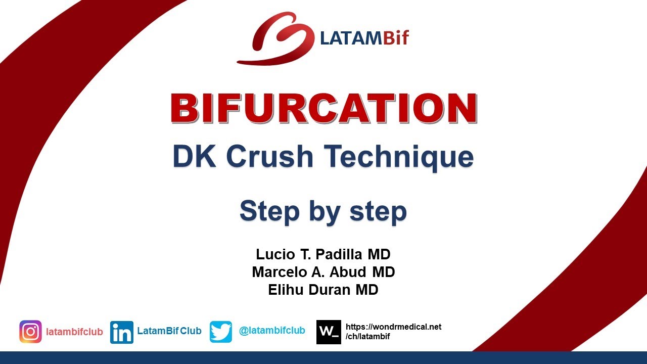 Bifurcations - DK Crush Technique -Step by step
