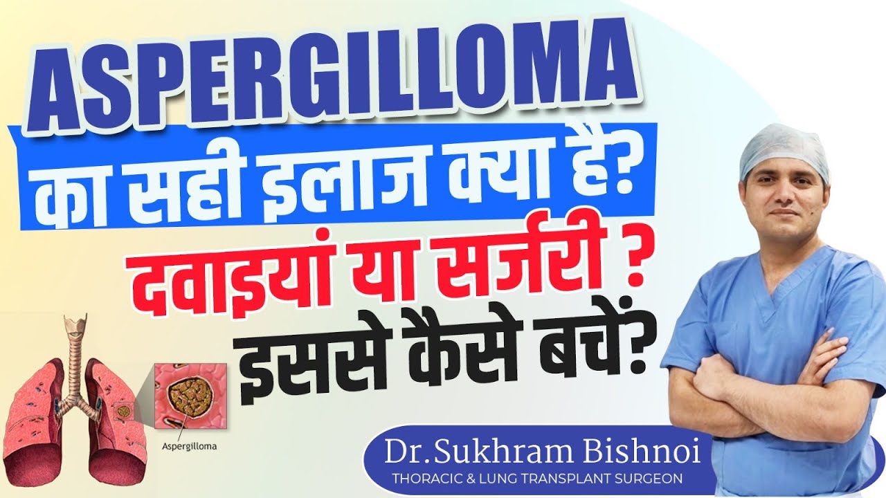Aspergilloma (Fungus Ball) का सही इलाज क्या है? l How to treat Aspergilloma l Dr Sukhram Bishnoi