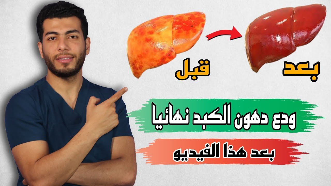 اسهل طريقه لازالة دهون الكبد وعلاج تشحم الكبد فى المنزل |دهون الكبد اعراضها وعلاجها ومدى خطورتها