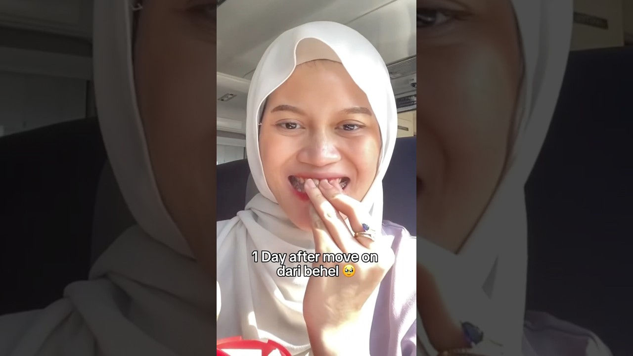 lihat deh journey Kak @ratnampd yang abis lepas behel terus move ke aligner!