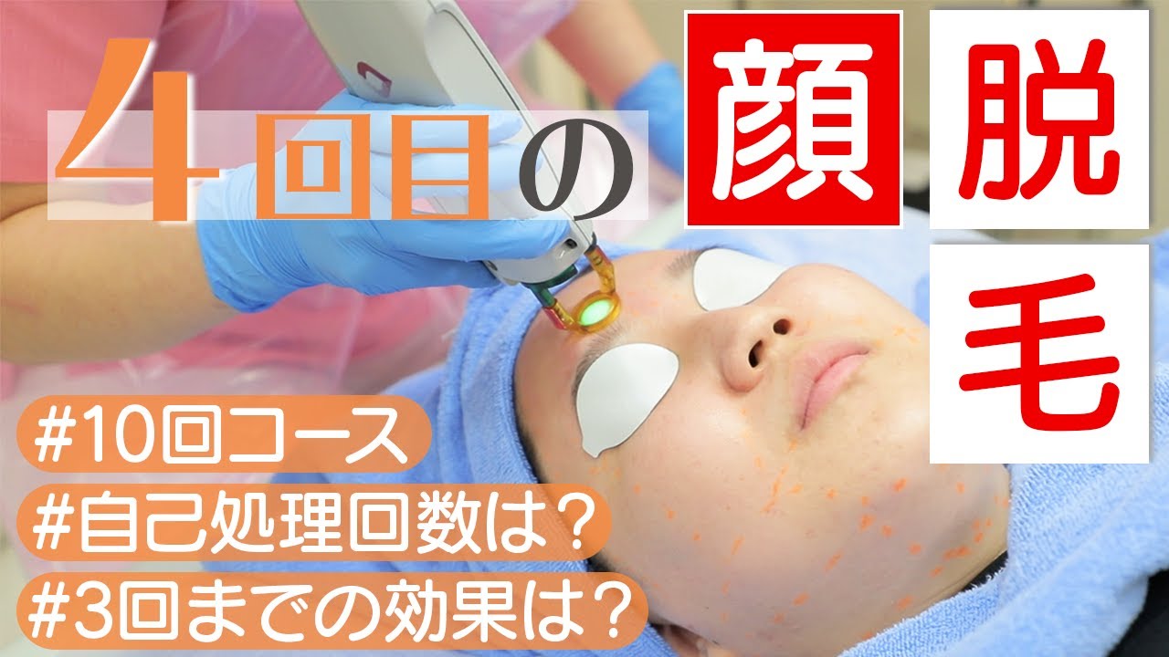 【顔脱毛#2】4回目の施術に密着! 3回で効果が明らかに⁈詳しく聞いてきました。