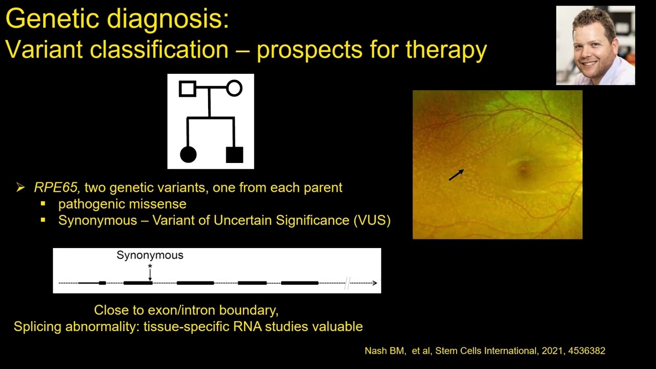 IRD Patient and Family Day 2024 | Gene therapy: a Luxturna implementation example