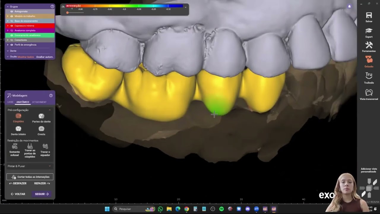 6° vídeo da série: 31 dias x 31 vídeos - Fixa sobre dentes, parte II