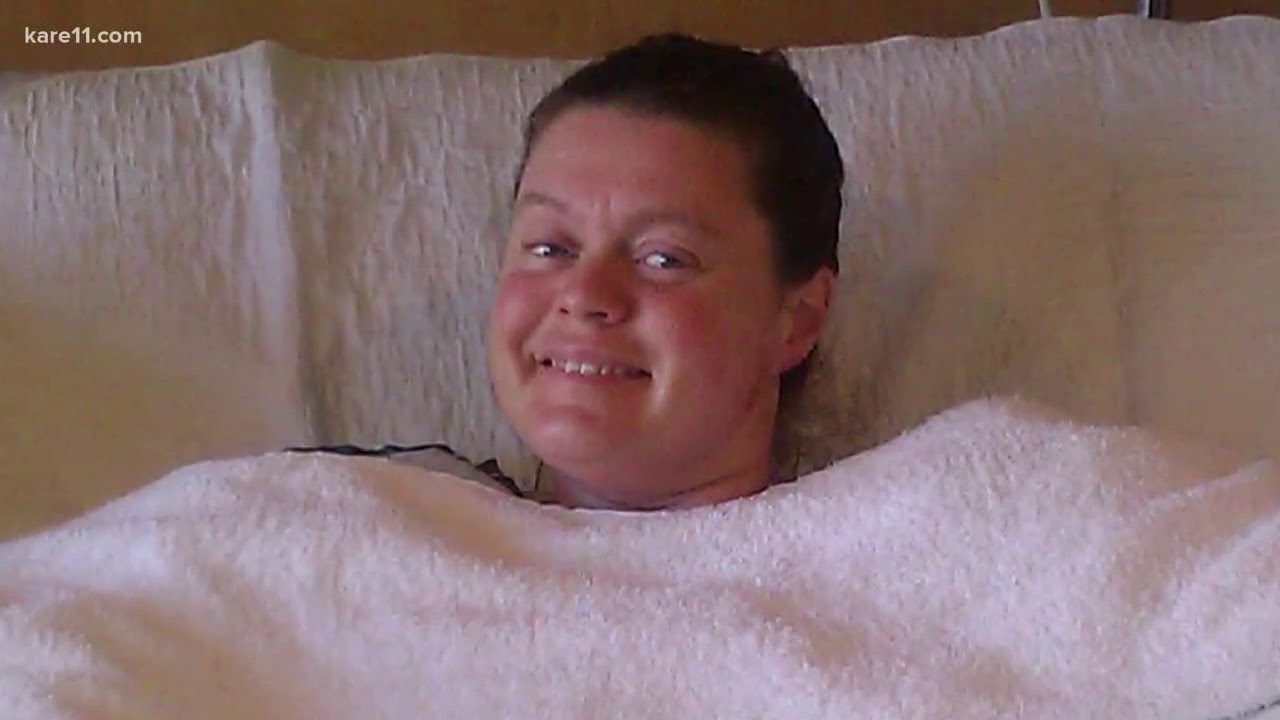 Burn survivor uses life to fight fires, support other survivors