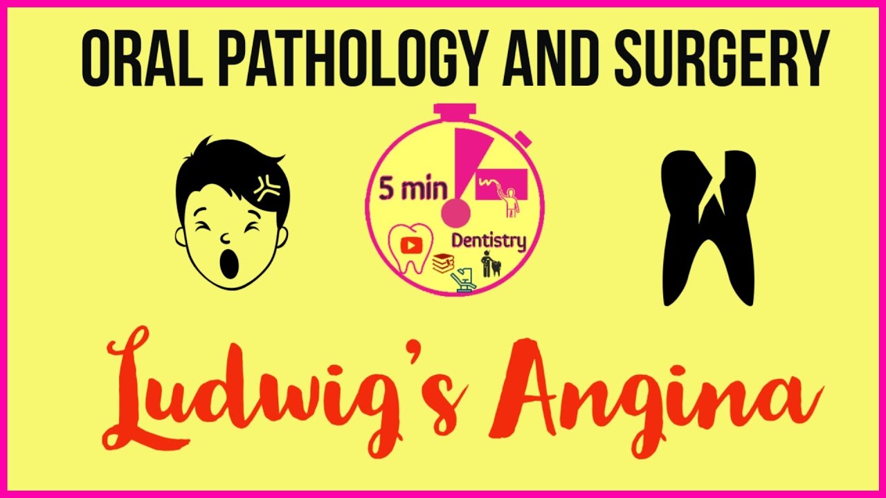 LUDWIG's ANGINA - QUICK NOTES - ORAL SURGERY - PATHOLOGY