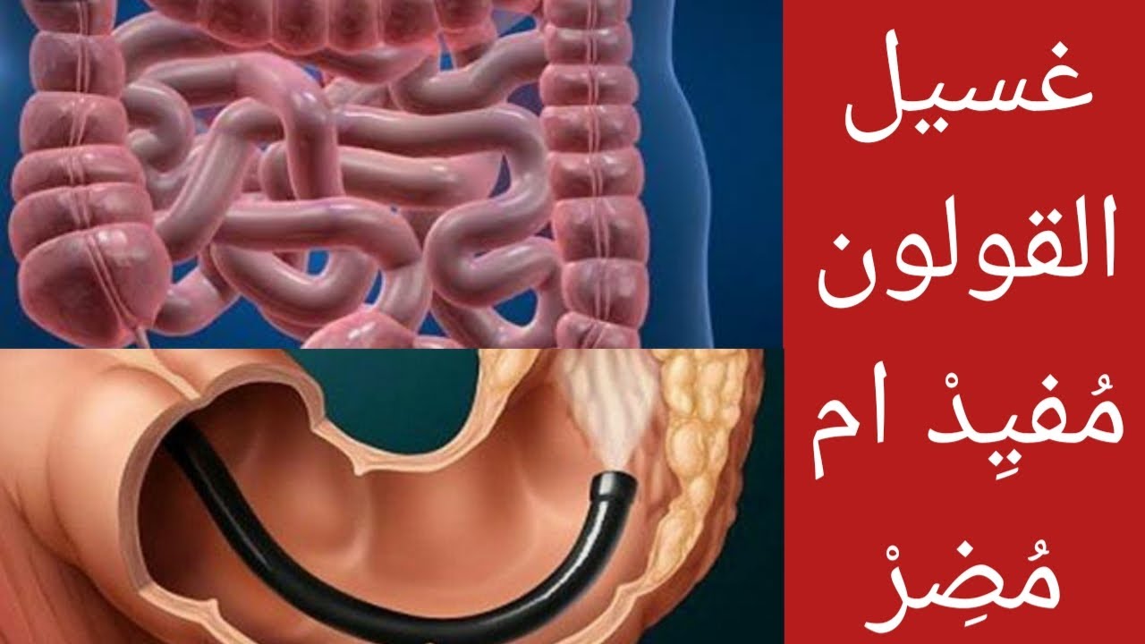 غسيل القولون مفيد أم مضر | أنواع غسيل القولون وكيفيه عمله