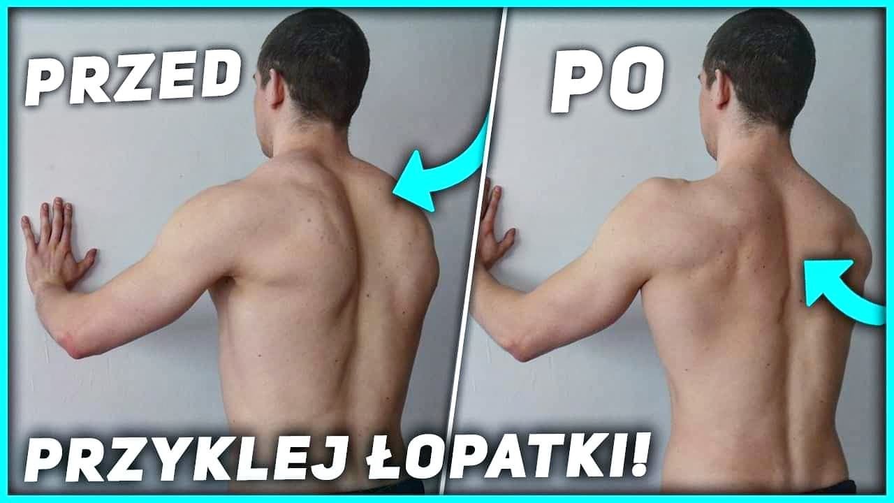NAPRAW ŁOPATKI ODSTAJĄCE *neutralne ustawienie łopatek*