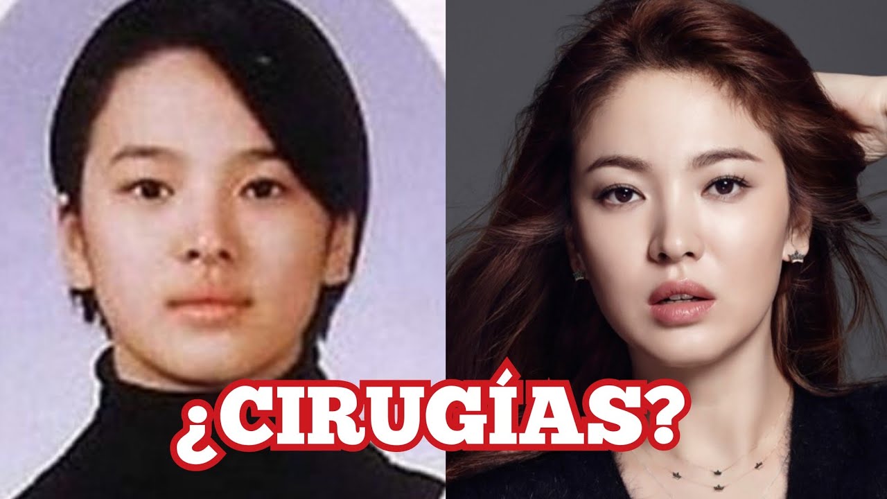 LAS CIRUGÍAS DE SONG HYE KYO