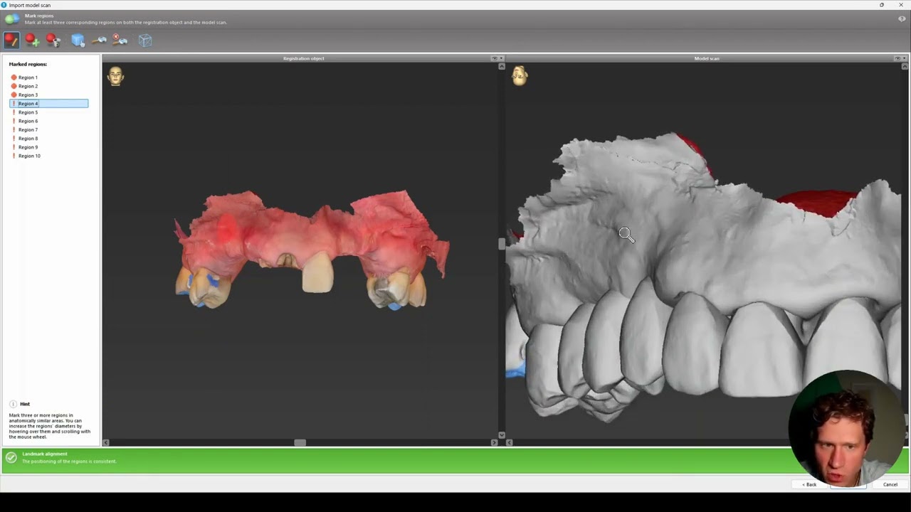How to Import Digital Waxup in coDiagnostiX