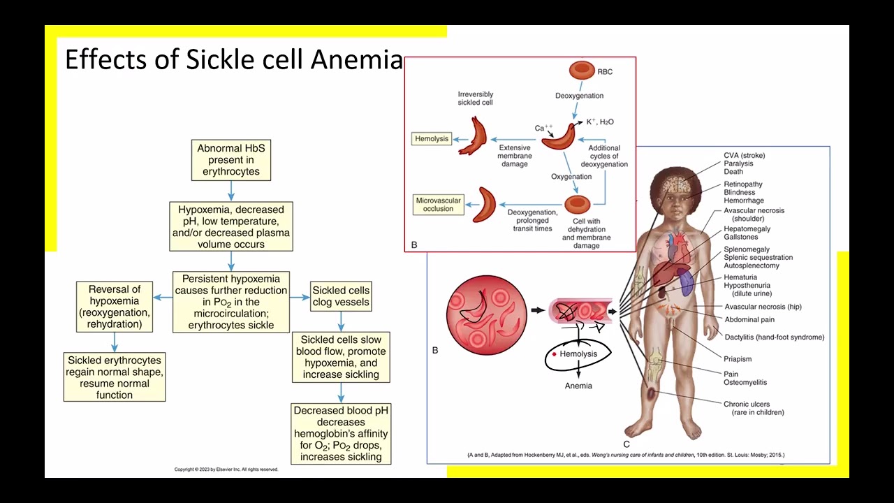 1A Disorders of RBCs