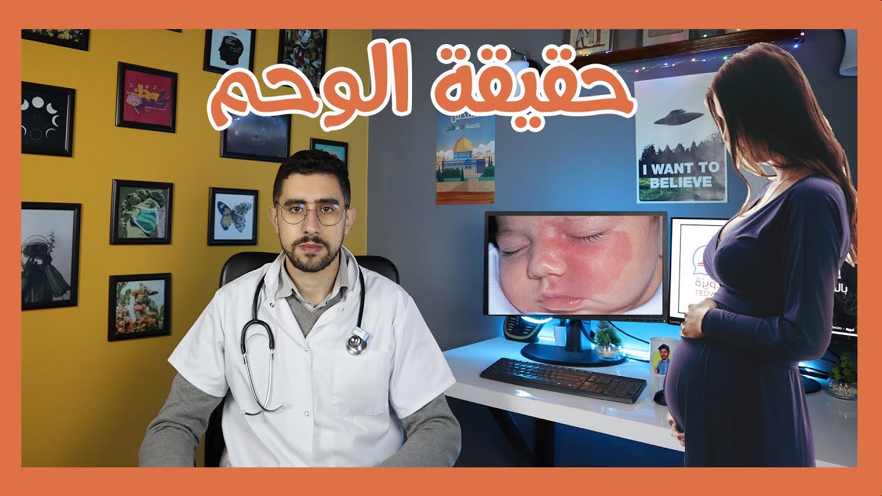 الوحم....حقيقة ام وهم ؟