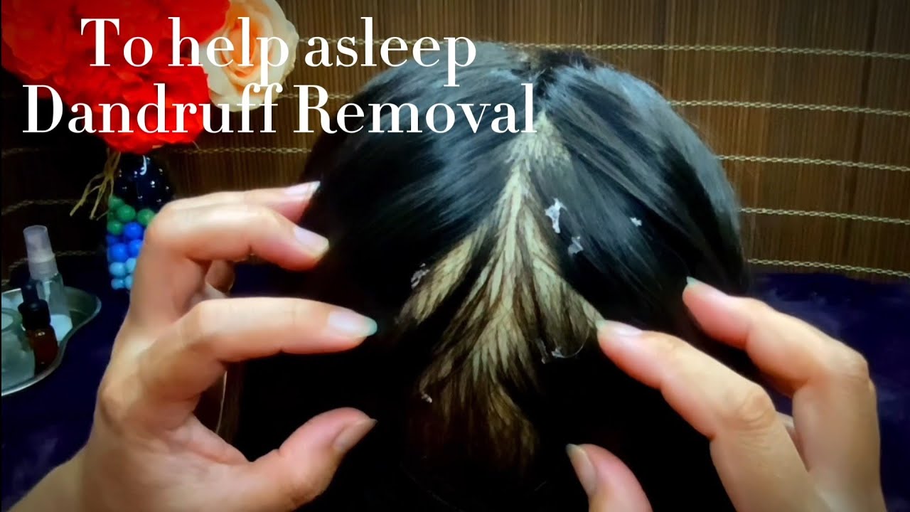 ASMR To Help You Fall Asleep, Dandruff Removal | No Talking 💤😴🥱🥱