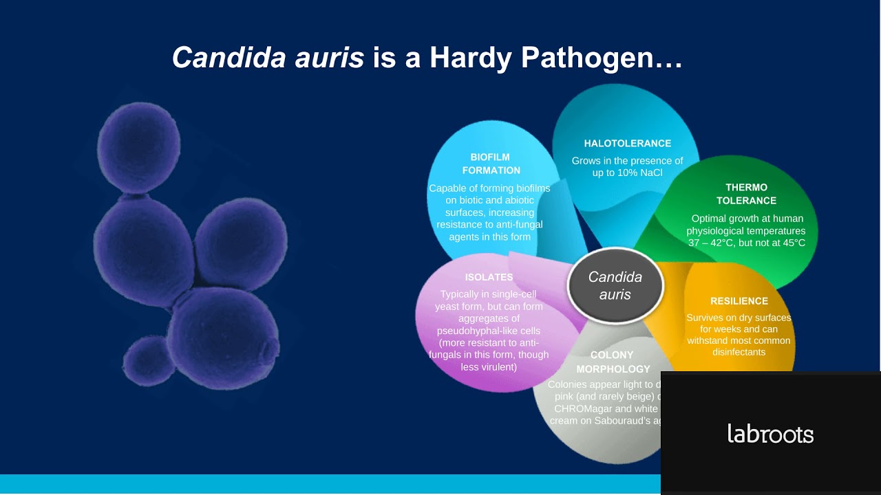 Candida auris: PCR Screening for Infection Prevention