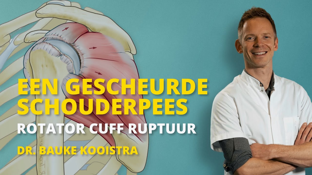 Gescheurde schouderpees (rotator cuff ruptuur)